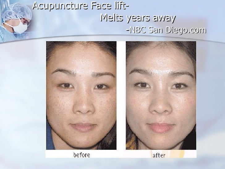 Reventin theraputic facial complex Super busty diva